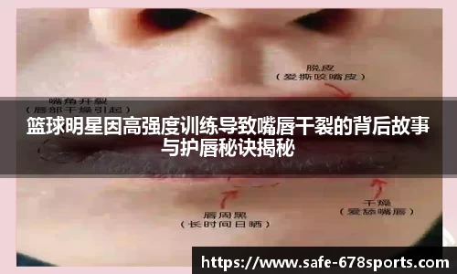 篮球明星因高强度训练导致嘴唇干裂的背后故事与护唇秘诀揭秘